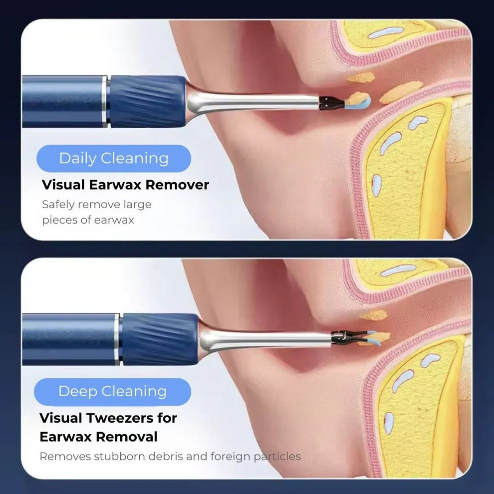 Smart Wireless Ear Cleaner with Camera (Android/iOS)